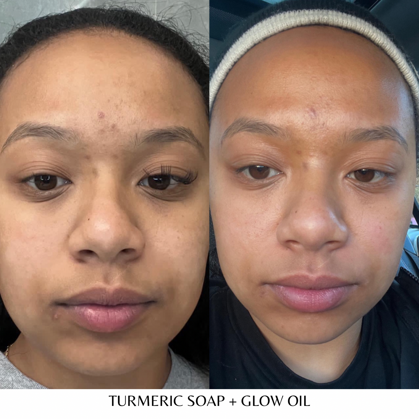Duo Skincare Bundle