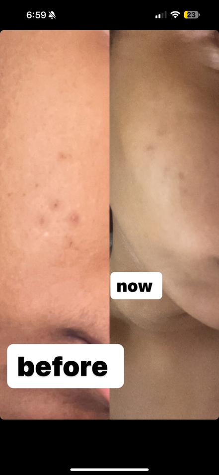 Glow Oil