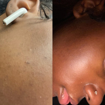 Glow Oil