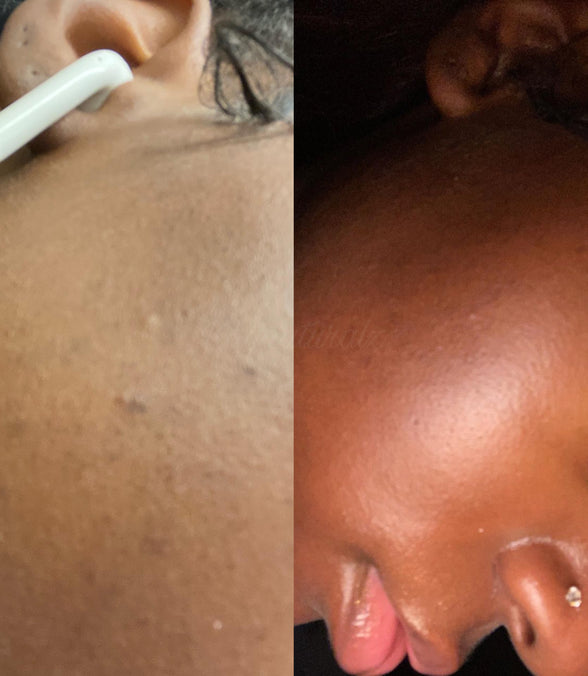 Glow Oil