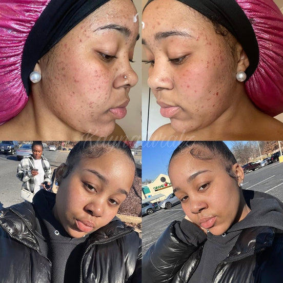 Customer before and after results