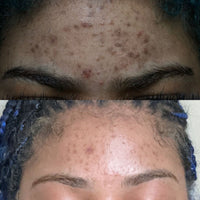 Customer before and after results