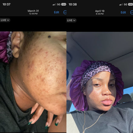 Organic Turmeric Soap Bar