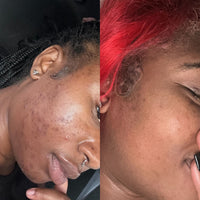 Customer before and after results