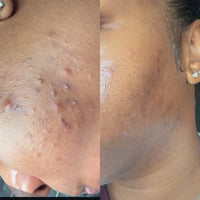KayNaturalz duo bundle